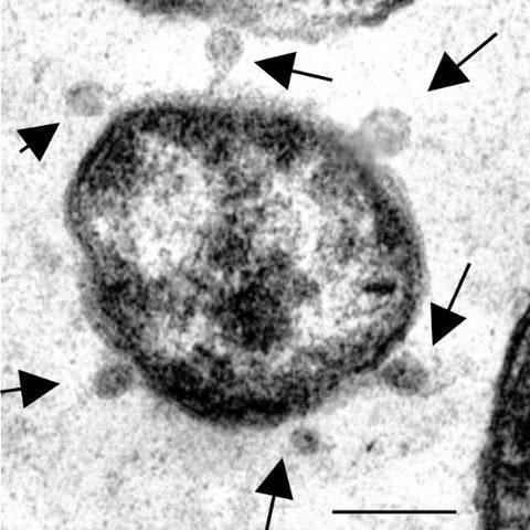 Bacterial Cell Leakage 